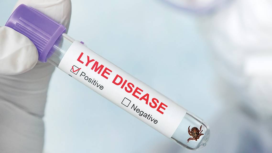 Screening for Biomarkers of Lyme Related Infection