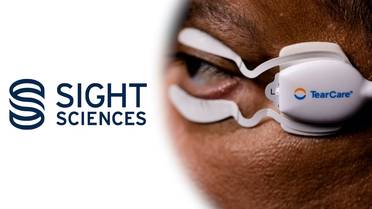Sight Sciences Presents Phase 1 Results of the SAHARA Trial Comparing TearCare to Restasis for the Treatment of Dry Eye Disea