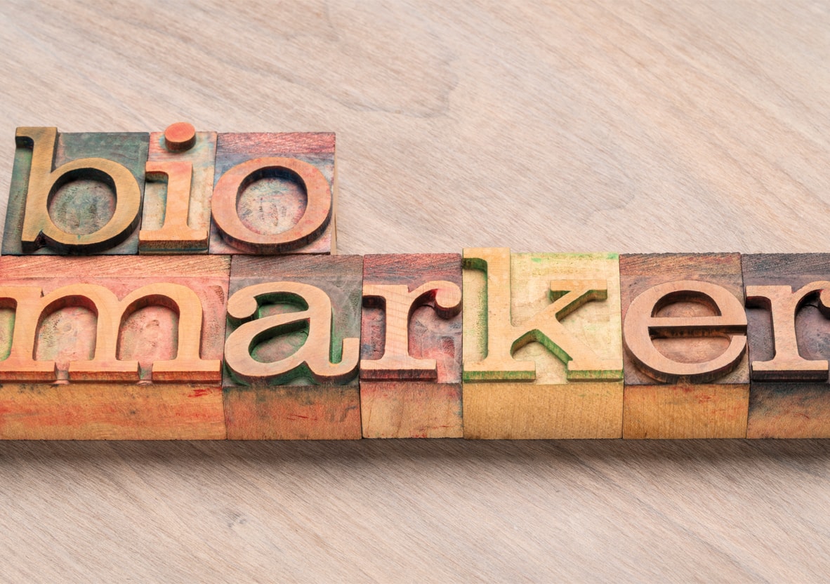 Tips for Recognizing and Understanding OCT Biomarkers