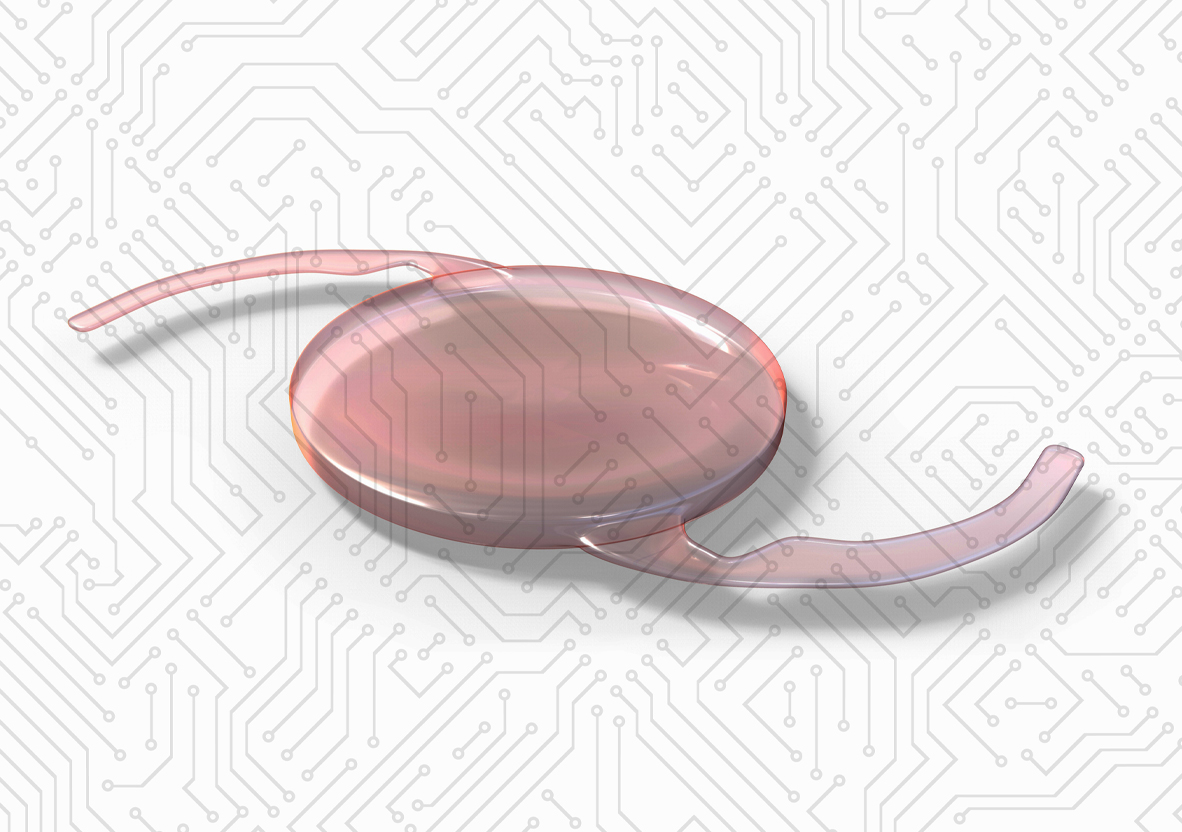 Innovations in IOL Technology