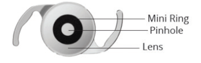 IOL Roundup